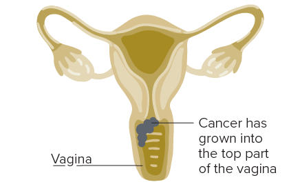 vagina diagram