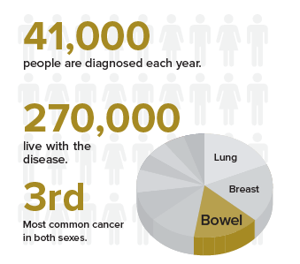 Bowel Cancer Graphic