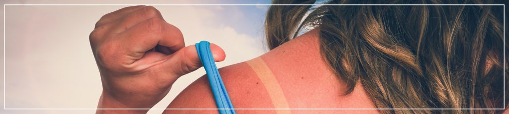 skin cancer