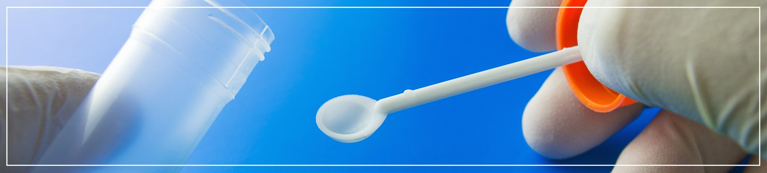 Stool Sample Diagnosis