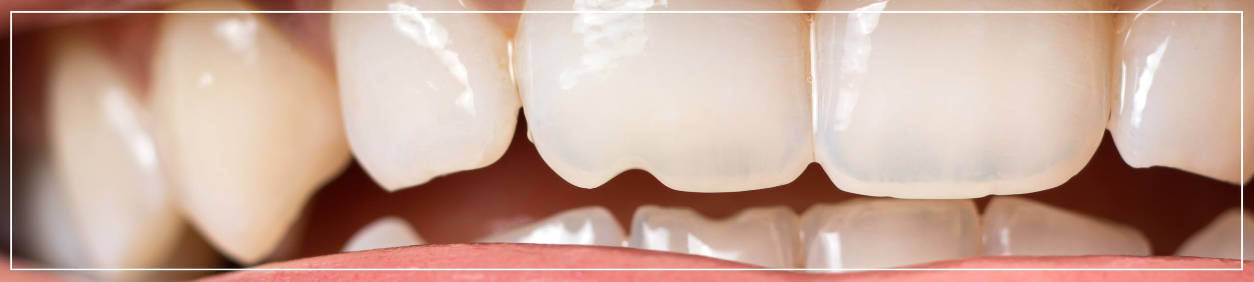 Wrongful Tooth Extraction