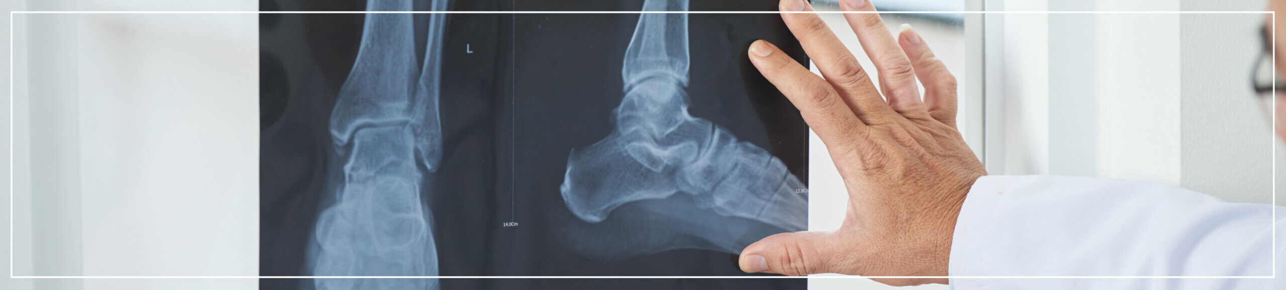 Delayed diagnosis case study