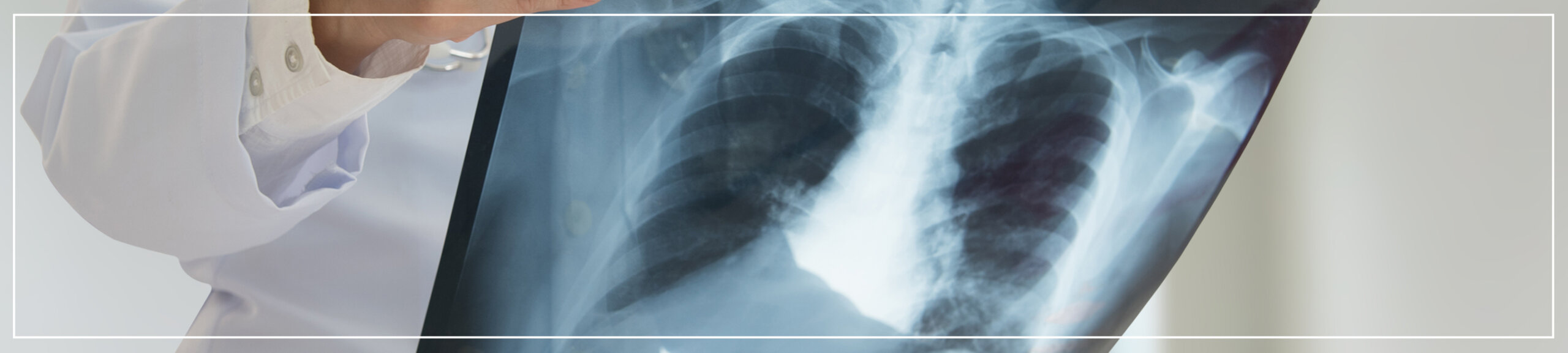 Diagnosis of mesothelioma