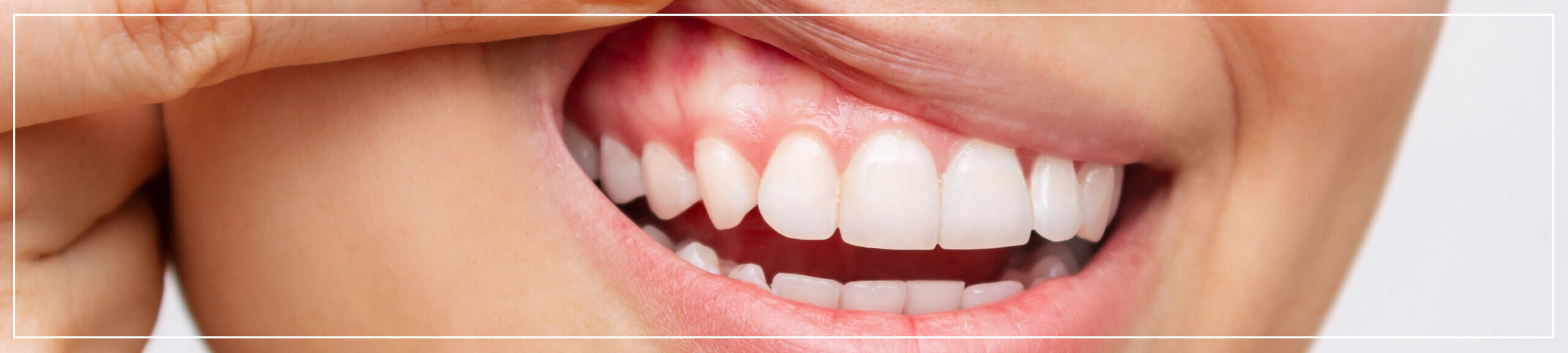 Invisible braces and Invisalign