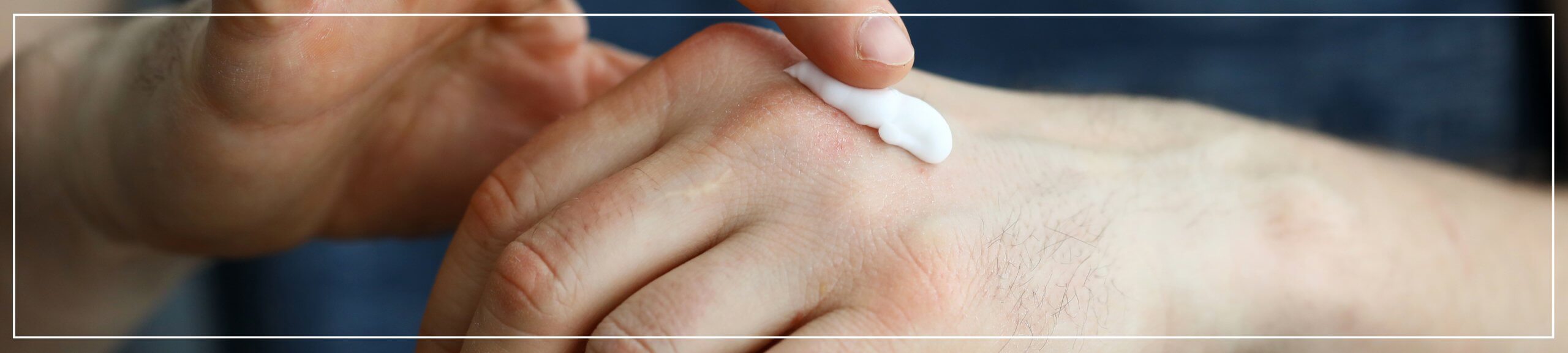 Damaged skin barrier