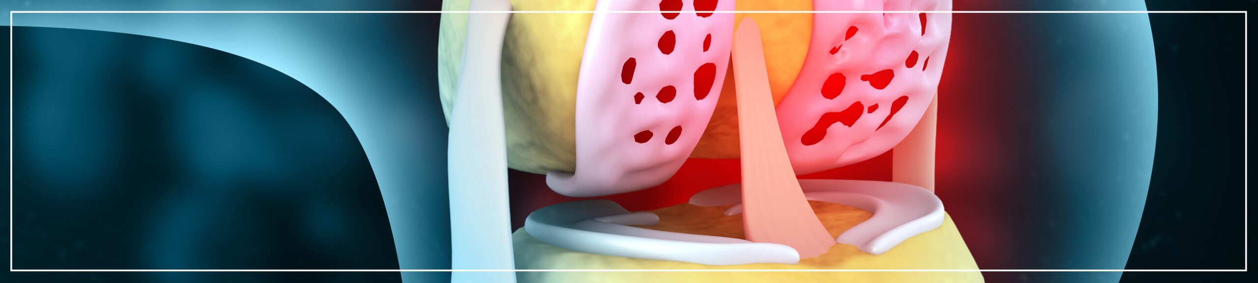 Orthopaedic Negligence Claims