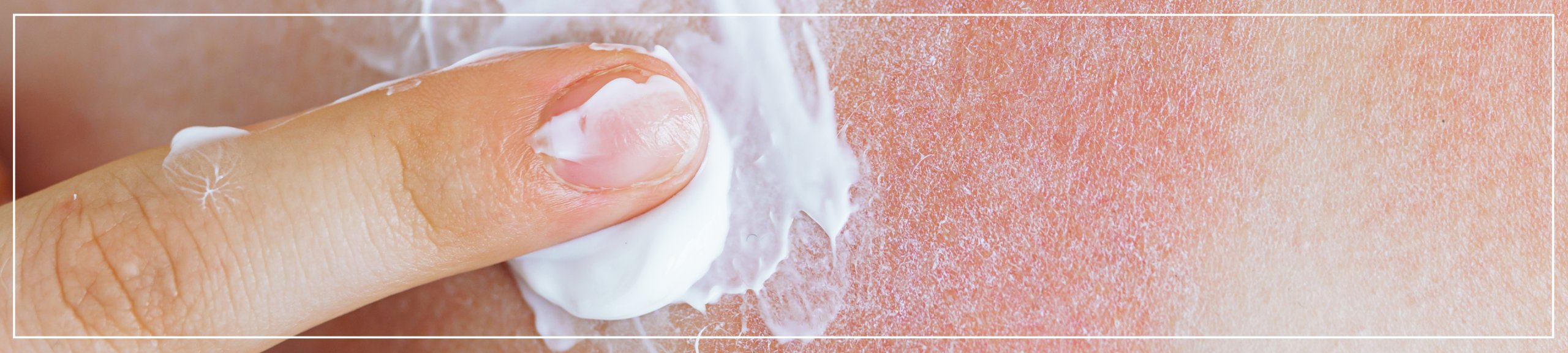 Skin Cancer Awareness Month