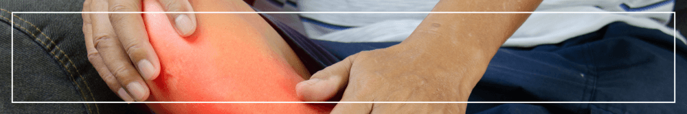 inflamed knee