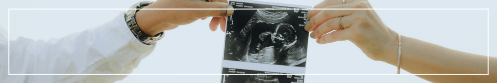 couple holding baby scan